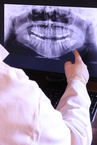 Best Holiday Emergency Dentist in Wlowbrook, IL