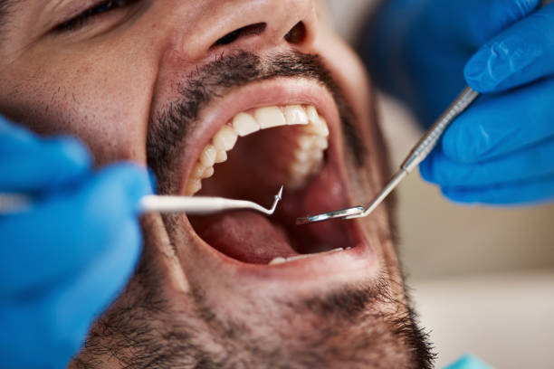 Best Broken or Cracked Tooth Emergency Dentist in Wlowbrook, IL