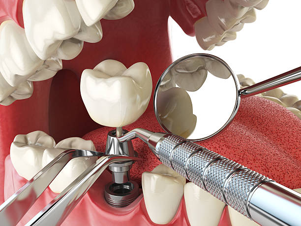 Best Mobile Emergency Dentist in Wlowbrook, IL